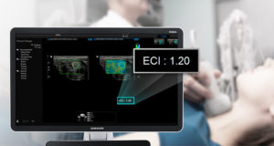 elastoscan